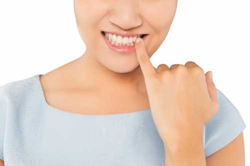 如何預防唇腭裂的發生？