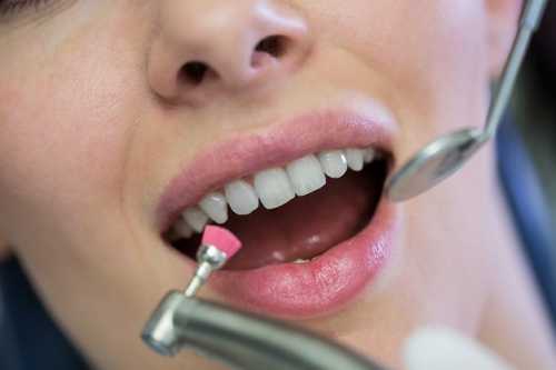 正畸治療後牙龈狀態會變得不如從前？