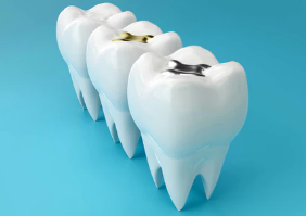 種植牙能用多久？能否做到這6點，決定種植牙的壽命