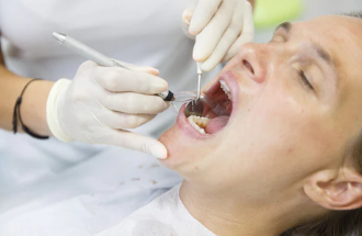 【新聞】世衛：全球約35億人有口腔疾病