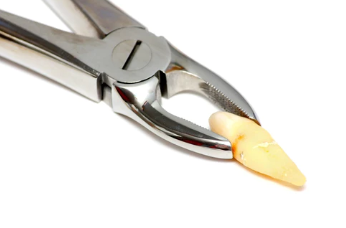 有點慘！蕭山一姑娘拔完智齒，3天才止血，瘦了8斤，網友看完慌了……