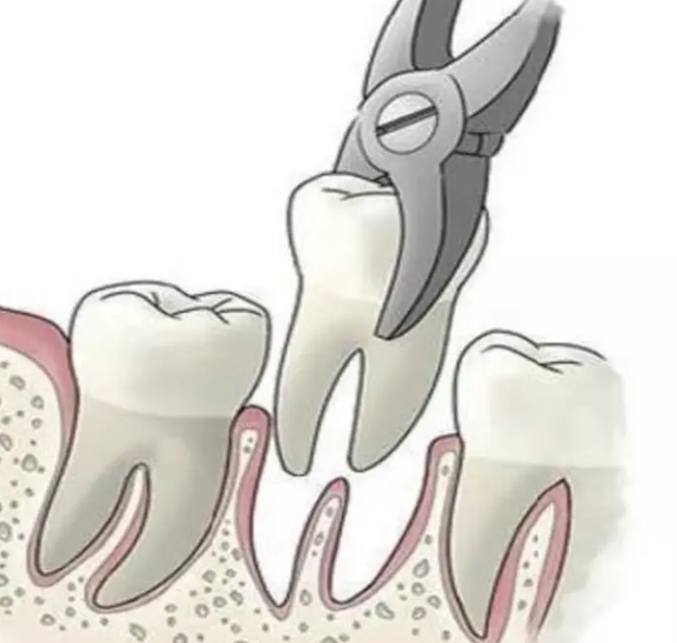 【店慶】睇牙就似努力早來早好 趁優惠更好
