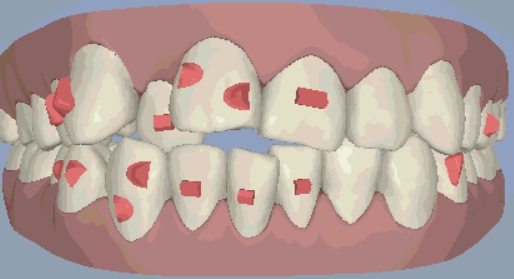 小朋友呢d牙齒問題不容忽視，需要及時治療