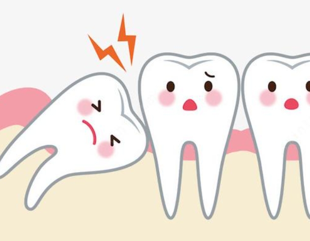 咩係智齒？對人體有咩危害-智齒是否都要拔除