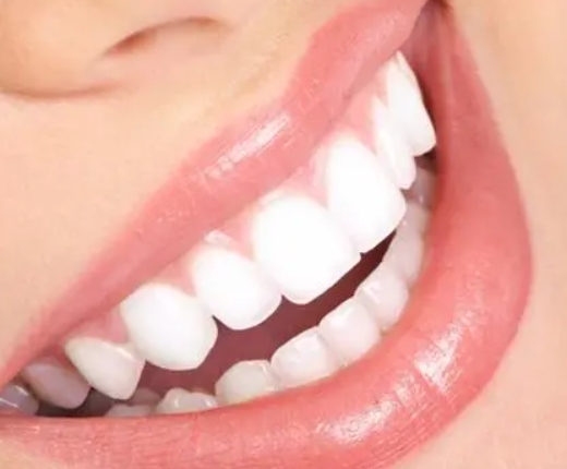 【洗牙】洗牙嘅時候疼痛感比別人明顯，好可能係因爲......