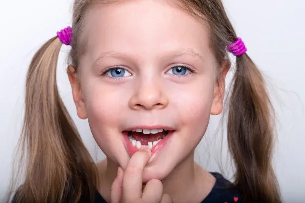 深圳牙齒美白的關鍵注意事項及建議指南