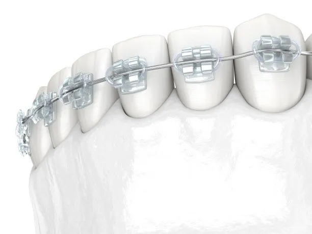 在深圳拔牙前後必知的注意事項與護理指南