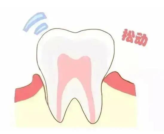 種牙科普，珠海牙槽骨萎縮了還能種牙咩