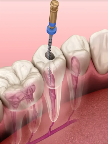 澳門牙科診所，北上睇牙怎麽找到好牙科？